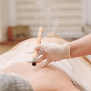 acupuncturist-moxibustion-on-female-back