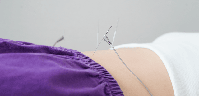 Eletroacpunture-on-female-patient-stomach