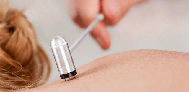 plum-blossom-acupuncture-treatment