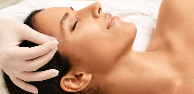 Clinical practitioner in gloves inserting a fine intradermal acupuncture needle near the eye zone of a relaxed female patient to perform cosmetic acupuncture
